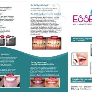 Broşür Grafik Tasarımı