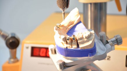 Almanya'da Türk Diş Laboratuvarları