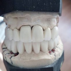 Era Dental Özel Diş Laboratuvarı