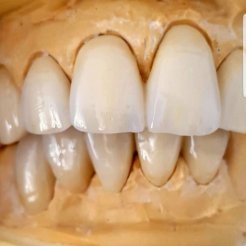 Era Dental Özel Diş Laboratuvarı